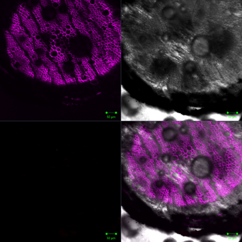 Confocal