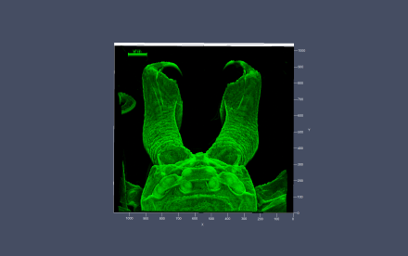 Confocal